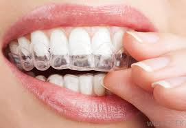 Teeth Whitening Trays